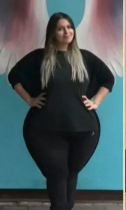15-yilda-87-kilo-vererek-63-kiloya-dustu-ameliyatsiz-nasil-kilo-verdigini-tek-tek-anlatti-1721667234696.jpg Ameliyatsız nasıl kilo verdiğini tek tek anlattı! 1,5 yılda 87 kilo vererek 63 kiloya düştü!-6
