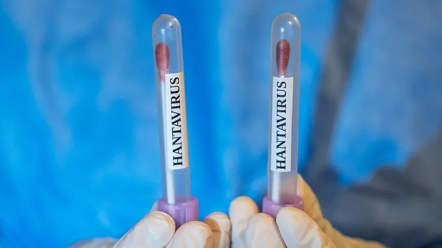hantavirus-salgini-bitti-mi-dso-son-gorulen-olumlu-vakayi-acikladi-1781110846671.jpeg Hantavirüs salgını bitti mi? DSÖ son görülen ölümlü vakayı açıkladı-3