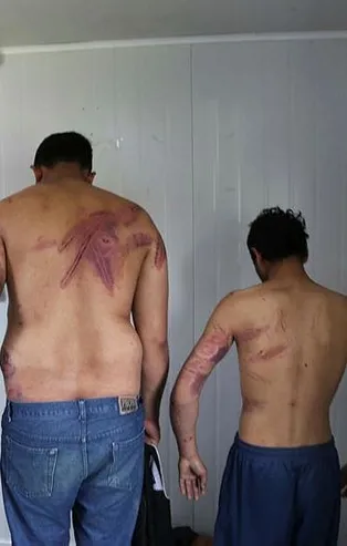 Yunanistan'dan insanlık dışı uygulama!