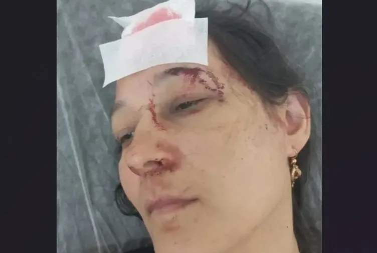 Yazlıkçı aileye aidat dayağı!