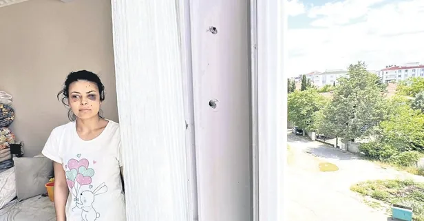 Düğünde maganda dehşeti: Pencere duran kadın gözlerinden yaralandı