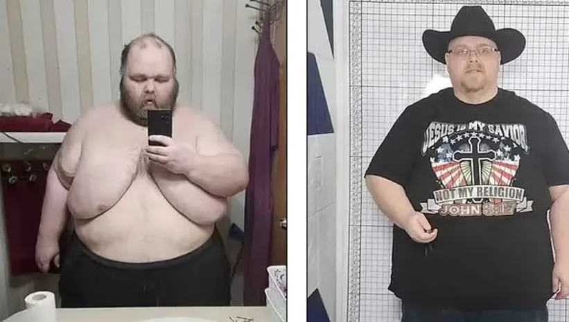 Sadece bu diyetle 125 kilo gitti! Doktorlar şaşkına döndü