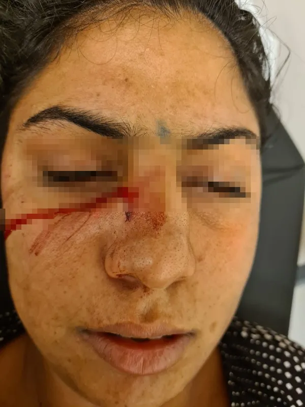 adanada-kendisine-kahvalti-hazirlamayan-esini-burnundan-bicaklayan-koca-tutuklandi-1604303373221.jpg Adana'da kendisine kahvaltı hazırlamayan eşini burnundan bıçaklayan koca tutuklandı-2