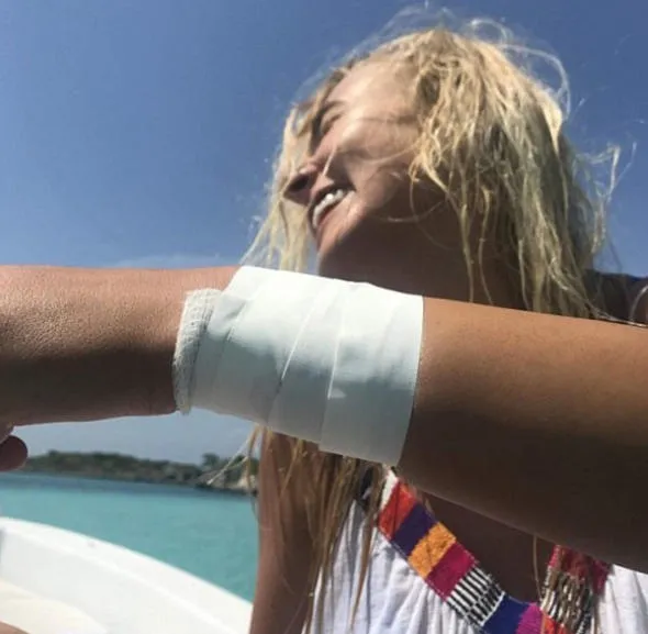 Instagram pozu vermek isteyen Katarina Zatutskie köpek balığı saldırısına uğradı-4
