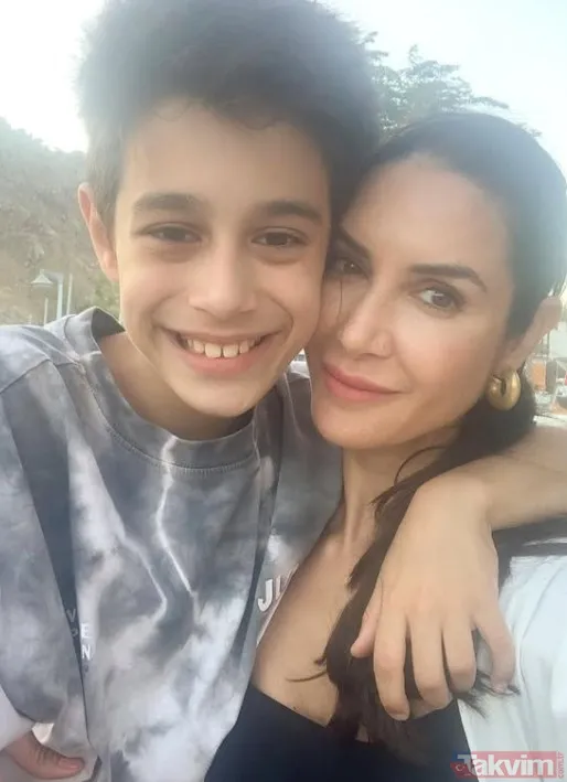 Ahu Yağtu apar topar hastaneye kaldırıldı! Menajerlik şirketinden açıklama! Beyin anevrizması nedir, belirtileri neler? - 8