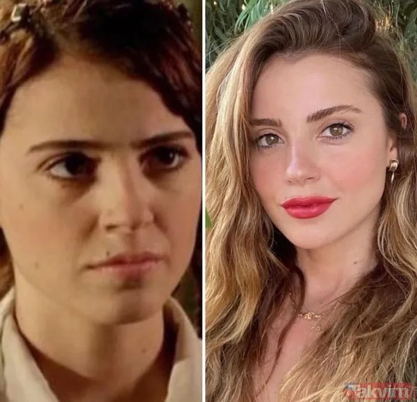 Esra Bilgiç estetik harikası çıktı! Eski halini görenin gözleri fal taşı gibi açıldı: Doğal sanıyordum! Diriliş Ertuğrul’un yıldızı... - 7