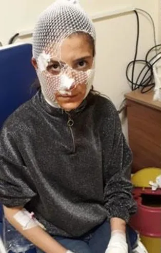 Adana'da sokak ortasında dehşet! Genç kadına 80 dikiş atıldı