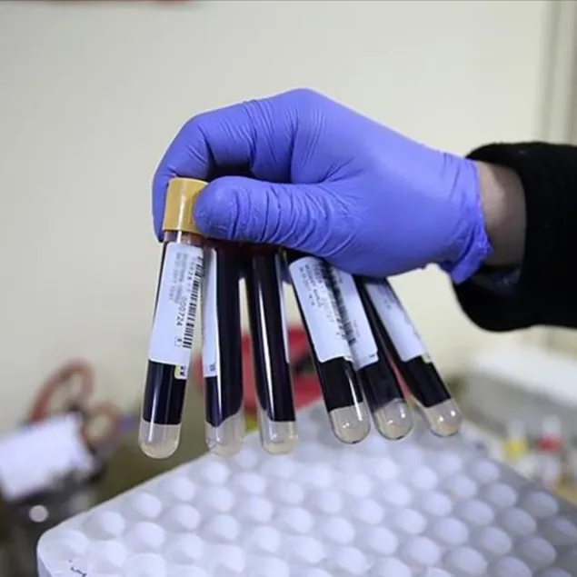 Demir eksikliği iştahsızlığa neden