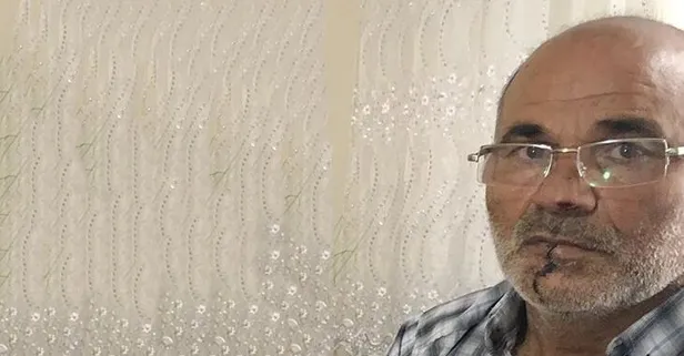 İstanbul Pendik’te öfkeli damat, kayınpederinin dudağını ısırdı!