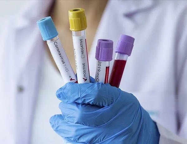 Sağlık Bakanlığı 10 Nisan 2021 koronavirüs vaka ve vefat tablosunu paylaştı | Türkiye Covid-19 hasta tablosu-3