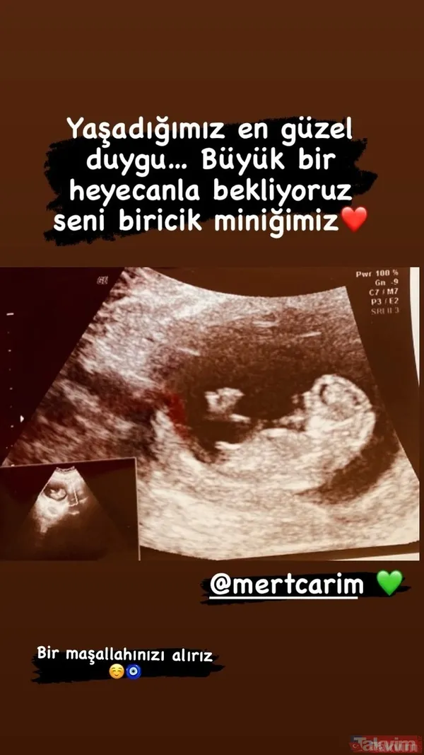 Bücür Cadı'nın Zeliş'i hamile olduğu müjdesini vermişti... Merve Erdoğan bebeğinin cinsiyetini açıkladı: "Aklınıza gelen isimleri bekliyorum" - 3