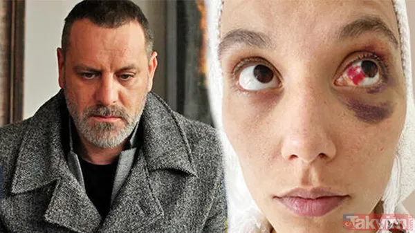 Deniz Bulutsuz İle Oyuncu Ozan Güven Arasında Yaşanan Darp Olayına İlişkin Yürütülen Soruşturmada Tamamlandı. Serenay Sarıkaya İle Aynı Dizide Rol Alan Ozan...