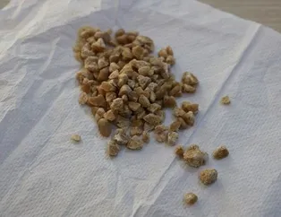 Tuzu abartma ’taş’ olma