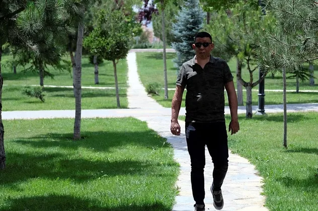 Vücudunun büyük bir bölümü yanan Gökhan Baran'ın hayatı, Başkan Erdoğan'ın talimatıyla değişti