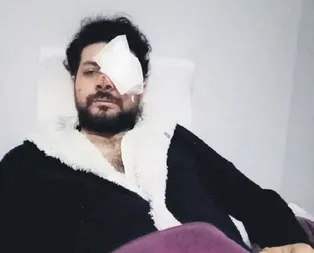 Magandalar yüzünden gözünü kaybetti