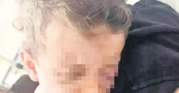 Denizli’de 2 yaşındaki bebeği öldüresiye döven caniden pişkin savunma!