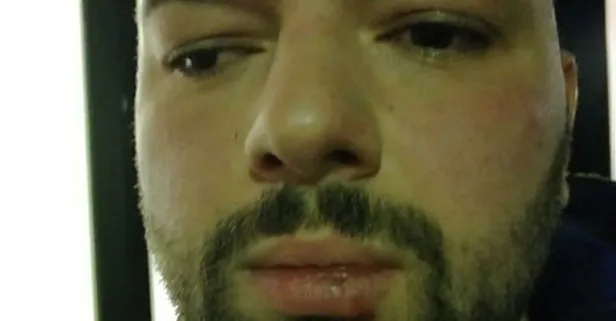 Almanya'da Türk iş adamı Alman polisi tarafından darbedildi