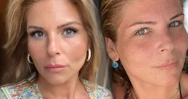 Pelin Öztekin bikinili pozlarına yenisini ekledi haftaya bakışım dedi! 93 kilo veren Pelin Öztekine bakın sosyal medya onu konuşuyor