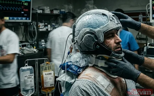 Araştırmaya katılan nörolog Alexander German, çalışmanın temel sorusunu şöyle özetliyor: "Beyin fonksiyonları fiziksel yapıdan kaynaklanıyorsa, tamamen...