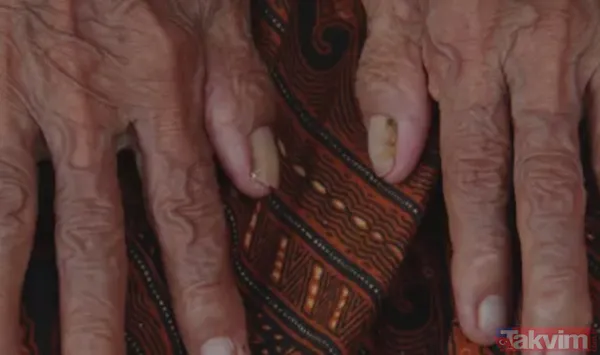 Cilt kırışıklıklarını gidermek için doğal yöntemlerden bir tane daha.