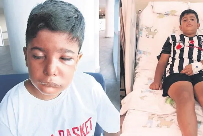 Sıra ’diş’i kabus