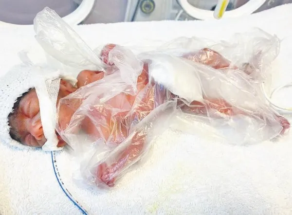 1691355774445.jpeg 650 gram doğmuştu! Zehra bebek yaşama inandı ve 211 günlük yoğun bakım savaşını kazandı-1