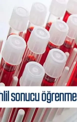 T.C. kimlik no ile tahlil sonucu öğrenme! Korona test sonucu - covid test sonucu sorgulama