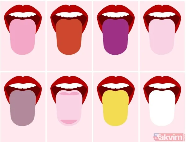 Uzmanlara Göre, Dilde Oluşan Renk Değişimleri, Şekil Bozuklukları Ve Yüzeydeki Kaplamalar, Vücudun İçinde Olup Bitenlere Dair Önemli Sinyaller Taşıyor.