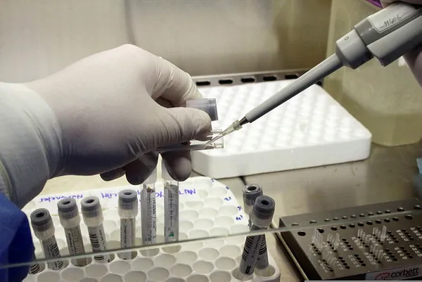 sivrisinekler-koronavirus-tasiyor-iddiasi-cok-konusulmustu-ve-kanitlandi-1614852679074.jpg "Sivrisinekler koronavirüs taşıyor" iddiası çok konuşulmuştu! Ve kanıtlandı...-4