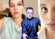 Ozan Güven tarafından darp edilen Deniz Bulutsuzdan kadına şiddete karşı paylaşım
