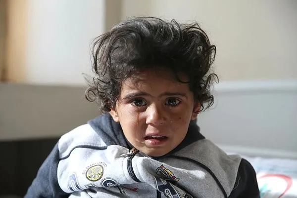 YPG'nin saldırısında yaralanan çocuklar Türkiye'de-10