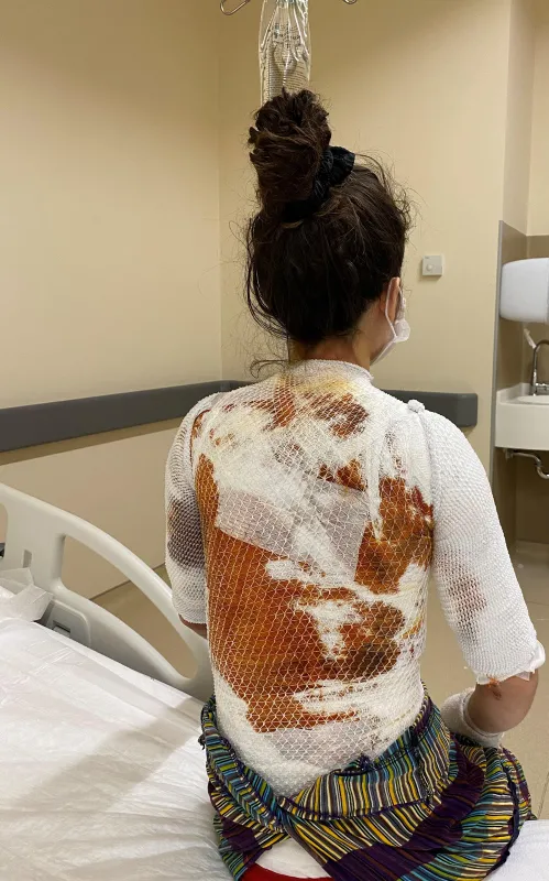 kendisini-ve-15-yasindaki-kizini-haslayan-kocasi-3-yil-9-ay-ceza-aldi-genc-kadinin-yardim-cigligi-yaptigi-isi-yarim-birakmayacak-1625558867254.jpg Kendisini ve 1,5 yaşındaki kızını haşlayan kocası 3 yıl 9 ay ceza aldı! Genç kadının yardım çığlığı: Yaptığı işi yarım bırakmayacak-4