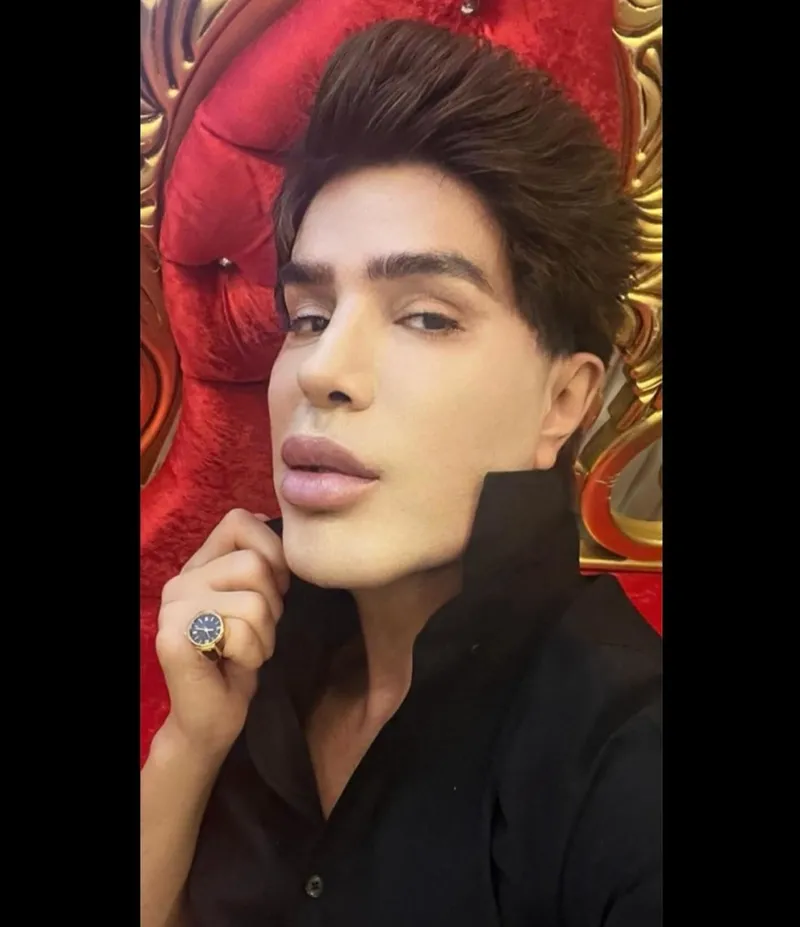 anne-acisi-sagligindan-etti-yilmaz-morgul-hastaneden-duyurdu-tedavi-olmak-zorundayim-1762152922561.jpg Kaynak: Sosyal medya