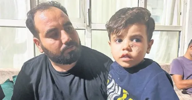 Maganda kurşunu 4 yaşındaki Ömer'i kör ediyordu