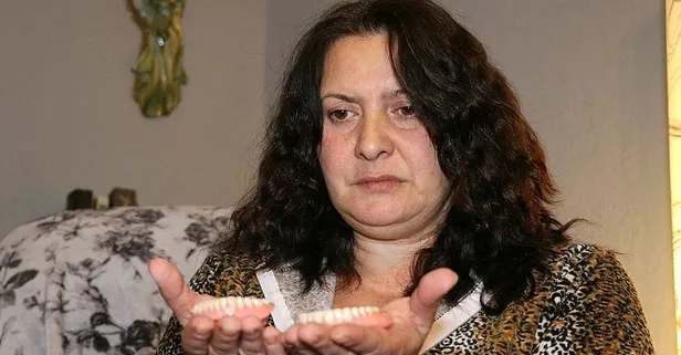 Bembeyaz dişler istedi 32 dişini de kaybetti! ’Delirten hastalığa’ yakalandı...