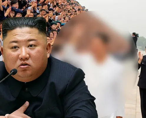 Kim Jong-Un zayıfladı, boynu ortaya çıktı