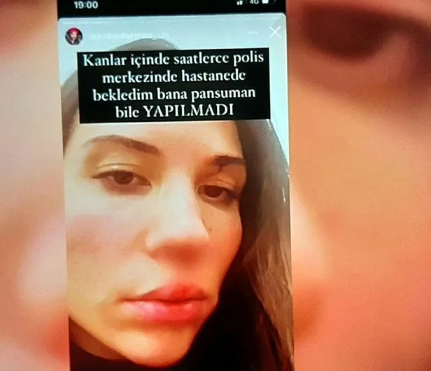 sen-bir-canavarsin-1644014066965.jpeg Eski futbolcu Özer Hurmacı eşi Mihriban Hurmacı'yı öldüresiye dövdü! "Sen tam bir canavarsın"-4