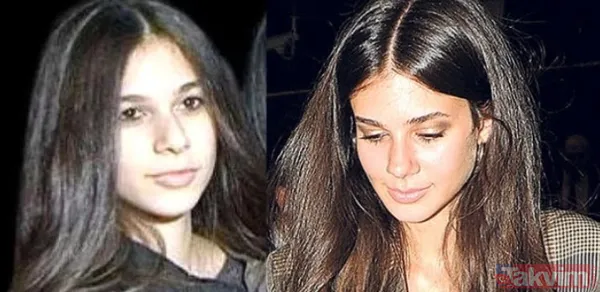 Ramo'nun Sibel'i Esra Bilgiç'in bu halini gören Esra olduğuna inanmıyor! Estetik var mı yok mu Esra Bilgiç açıkladı - 5