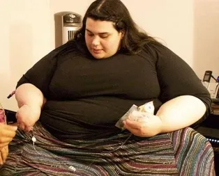 300 kiloya ulaşmıştı! Son hali şaşırttı