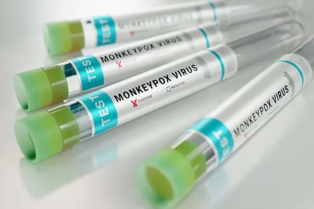 bakan-koca-uyardi-maymun-cicegi-virusu-turkiyede-hangi-ilde-goruldu-maymun-cicegi-virusu-belirtileri-neler-nas-1656572242233.jpg BAKAN KOCA UYARDI! Maymun Çiçeği Virüsü Türkiye'de hangi ilde görüldü? Hangi hastanede? Maymun Çiçeği virüsü belirtileri neler, nasıl bulaşır?-2