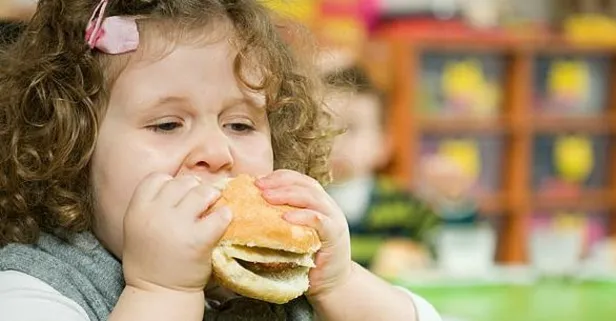 Obezite diyabet ve hipertansiyon gibi kronik hastalıklara neden oluyor! Uzmanı Obezitenin göz üzerindeki risklerini anlattı...