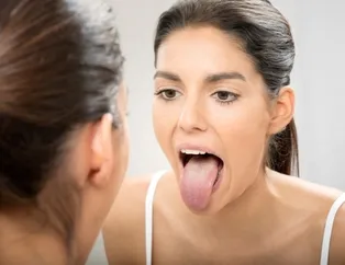 Dil temizliğinin önemi ve nasıl yapılması gerektiğini biliyor muydunuz? Dil hakkında hiç bilmediğiniz gerçekler...