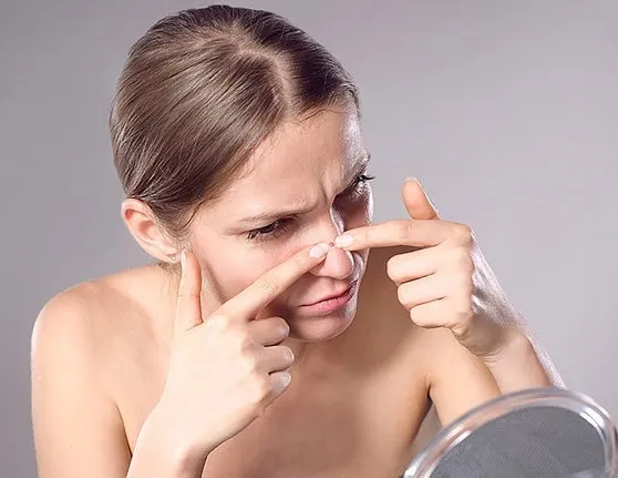 Her 5 kadından birinin yaptığı akneye yol açan 7 hatalı alışkanlık