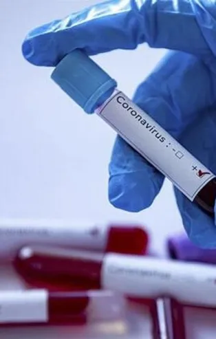 Başakşehir’de pozitif vaka