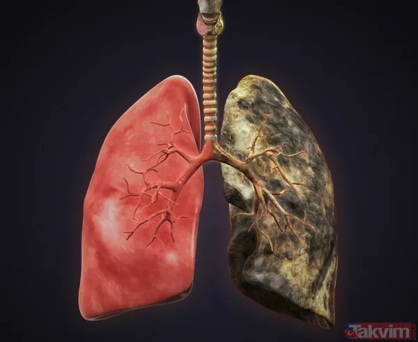 Vücuttaki zehri atmak için yalnızca tek kaşık yemek yeterli bir eşi daha yok! Sigara içenler bu mucize besini mutlaka tüketmeli - 17