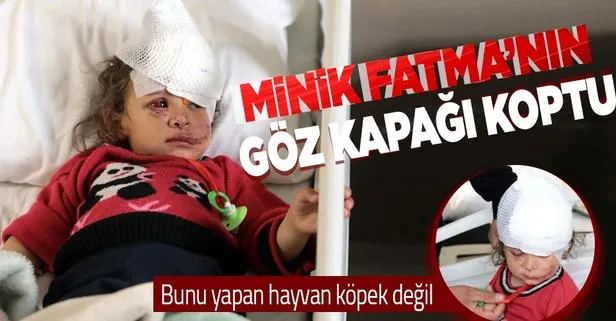 Minik Fatma’yı eşek ısırdı! Boyun bölgesinden alınan dokuyla göz kapağı yapıldı