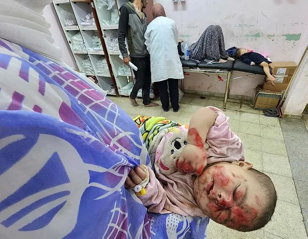 gazzede-icler-acisi-durum-tedavi-olmadigi-icin-siviller-olume-terk-edildi-defnedilemeyenlerin-bir-kismini-ise-1699822036193.jpeg Gazze'de içler acısı durum | Tedavi olmadığı için siviller ölüme terk edildi! Defnedilemeyenlerin bir kısmını ise köpekler parçaladı-2