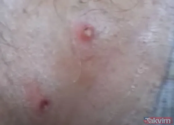 Karnındaki şişlik için gitti içinden çıkan doktorları bile şoke etti! Yer uzak değil Kayseri! 64 kilo girdi 55 kilo çıktı - 20