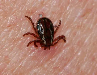 Bu hata öldürür! Kene ısırırsa sakın bunu yapmayın