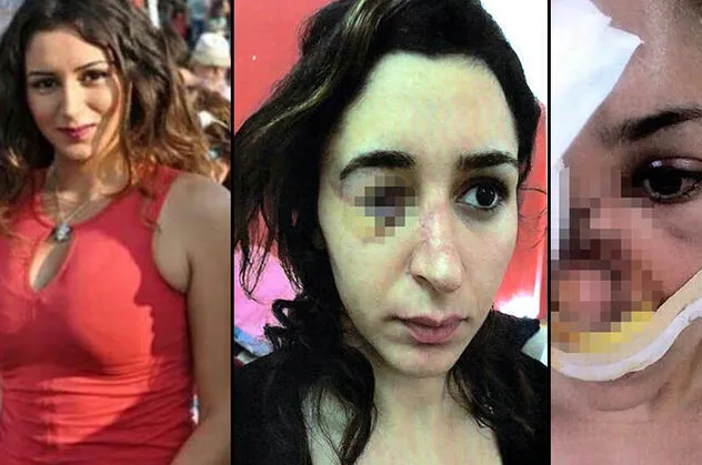 Tuğçe Aras A.'yı av tüfeğiyle vuran cani için istenen ceza belli oldu